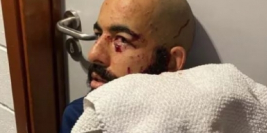 Médico explica ferimentos de jogadores do Bahia após ataque a ônibus: 'Danilo foi o mais atingido'