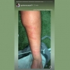 Scarpa mostra marcas na perna após vitória do Palmeiras sobre o Emelec